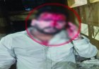 रायपुर  रायपुर में गैंगवार: दो गुटों के बीच चाकूबाजी और मारपीट, युवक गंभीर घायल